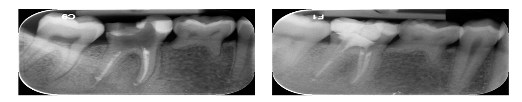 Endodonzia
