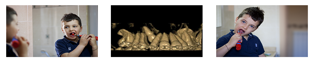 Odontoiatria pediatrica